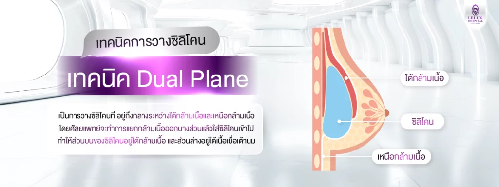 เทคนิค Dual Plane ผสมผสานระหว่างใต้กล้ามเนื้อและเหนือกล้ามเนื้อ