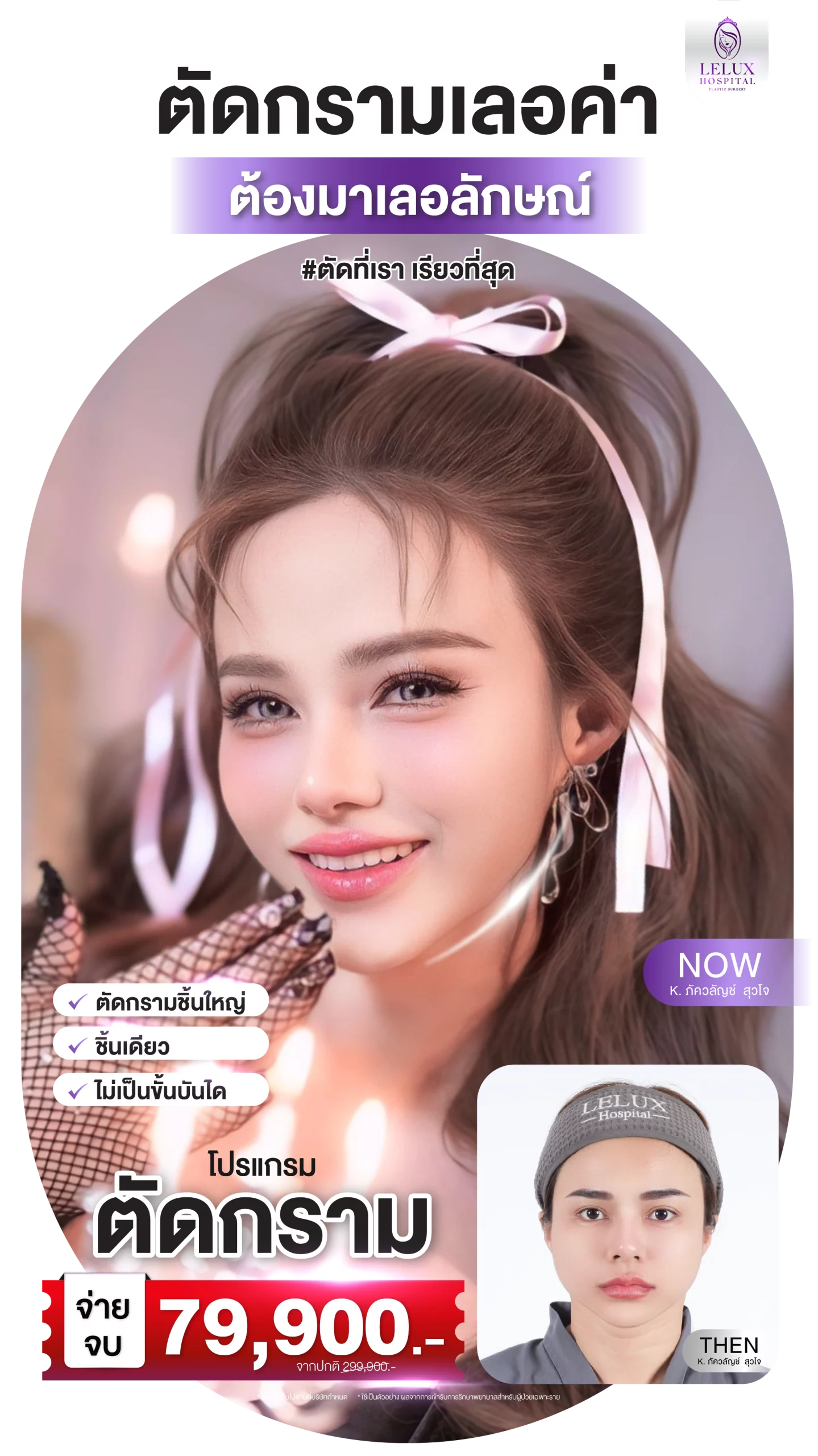 06-05-68 ads ตัดกราม คุณชมวิว 6-5-68-02