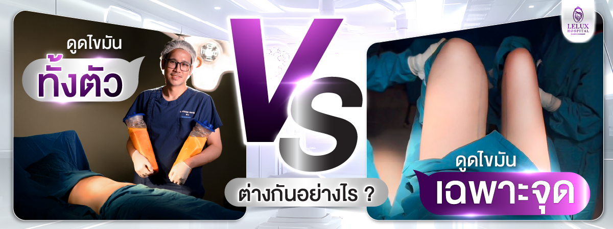 ดูดไขมันทั้งตัว vs ดูดเฉพาะจุด แตกต่างยังไง?
