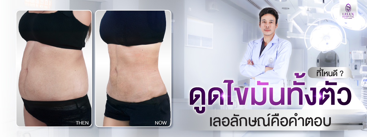 ดูดไขมันทั้งตัว ที่ไหนดี? เปิดเหตุผลที่เลอลักษณ์คือคำตอบ
