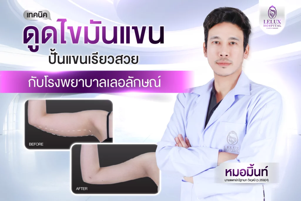 ดูดไขมันแขน ปั้นแขนเรียวสวยกับโรงพยาบาลเลอลักษณ์ ปลอดภัย เห็นผลไว