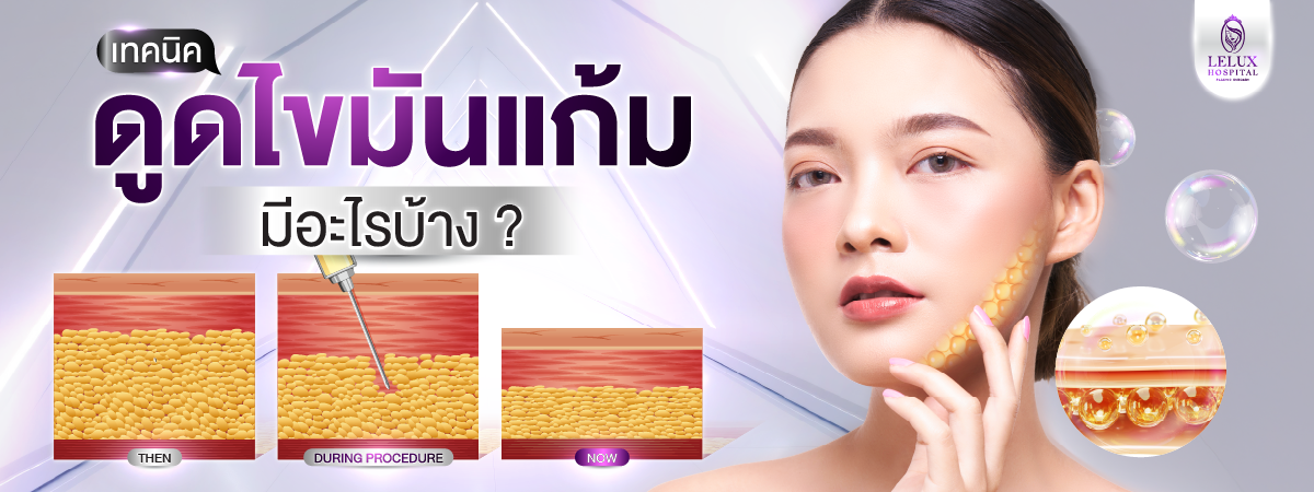 เทคนิคการดูดไขมันแก้มมีกี่แบบ ต่างกันอย่างไร