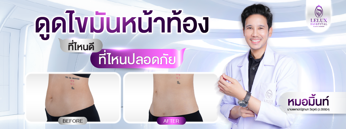 ดูดไขมันหน้าท้อง ที่ไหนดี? เลือกสถานพยาบาลอย่างไรให้ปลอดภัย