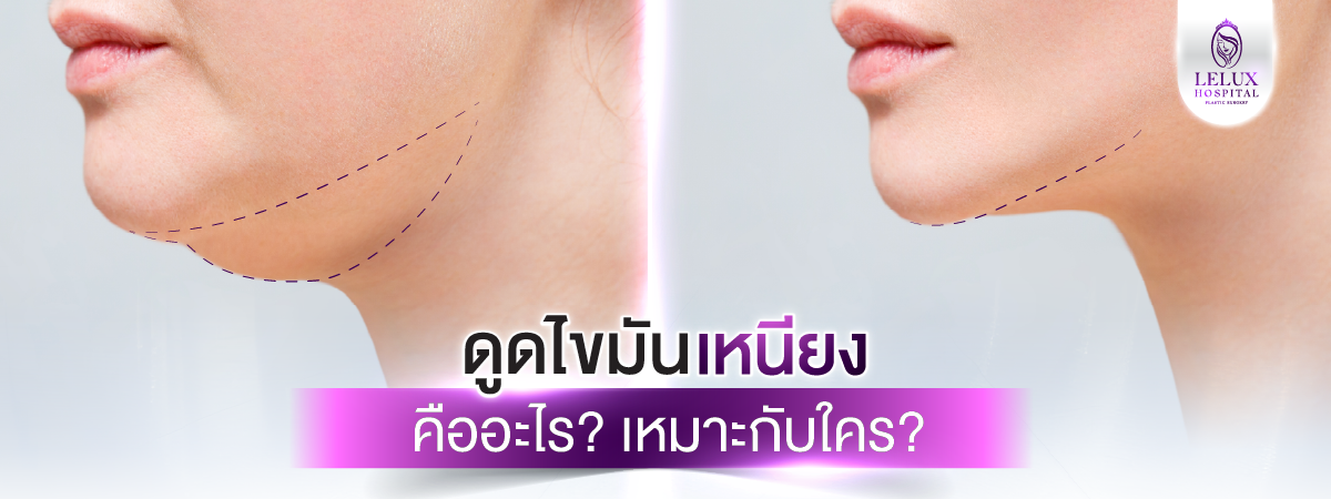 ดูดไขมันเหนียง คืออะไร? เหมาะกับใคร
