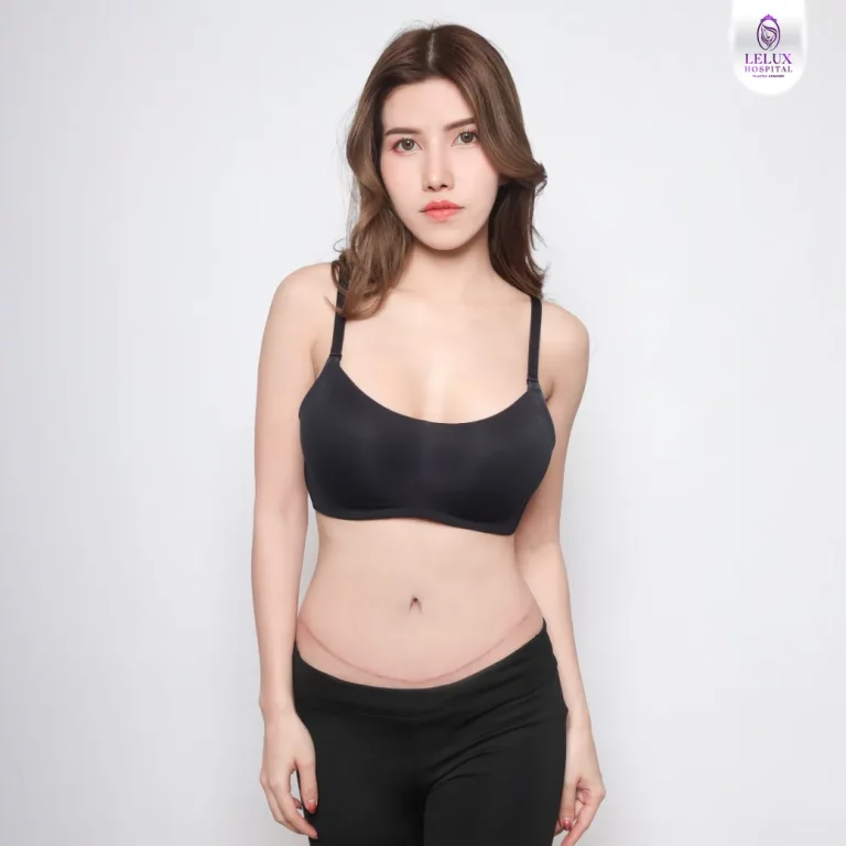 เคสตัดหนังหน้าท้อง-wep2_2