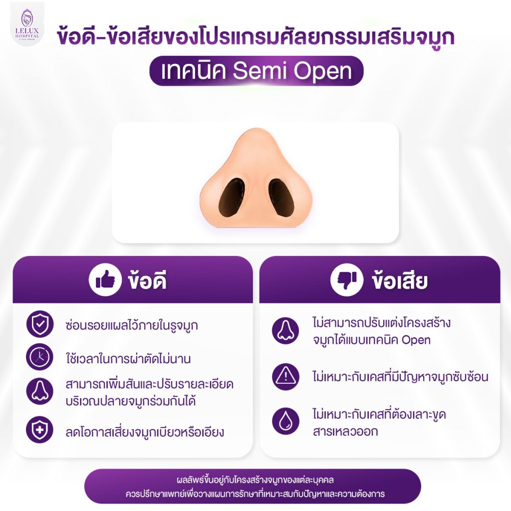 ข้อดีข้อเสียของโปรแกรมเสริมจมูก Semi Open
