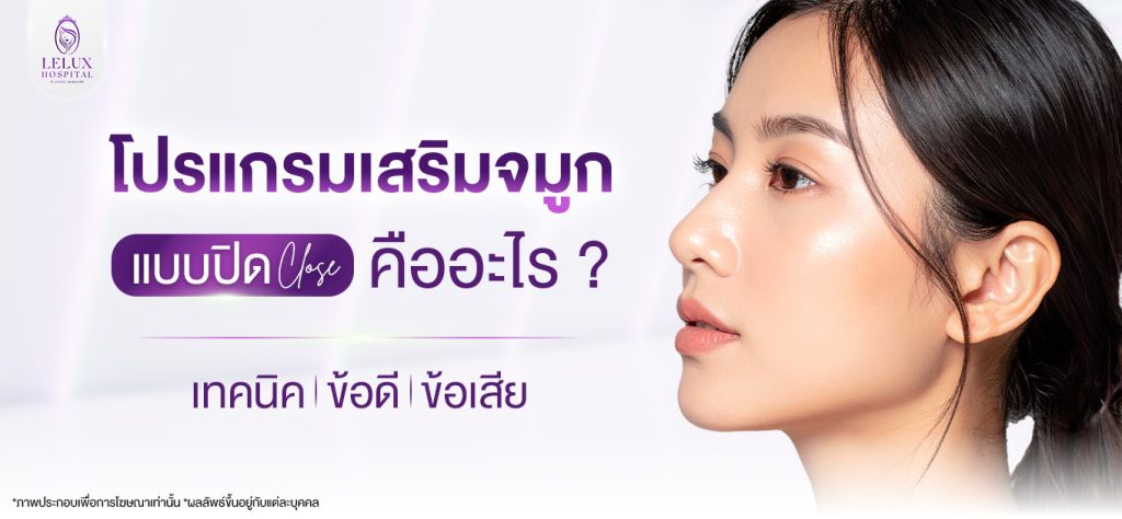 เสริมจมูกแบบปิด Close คืออะไร