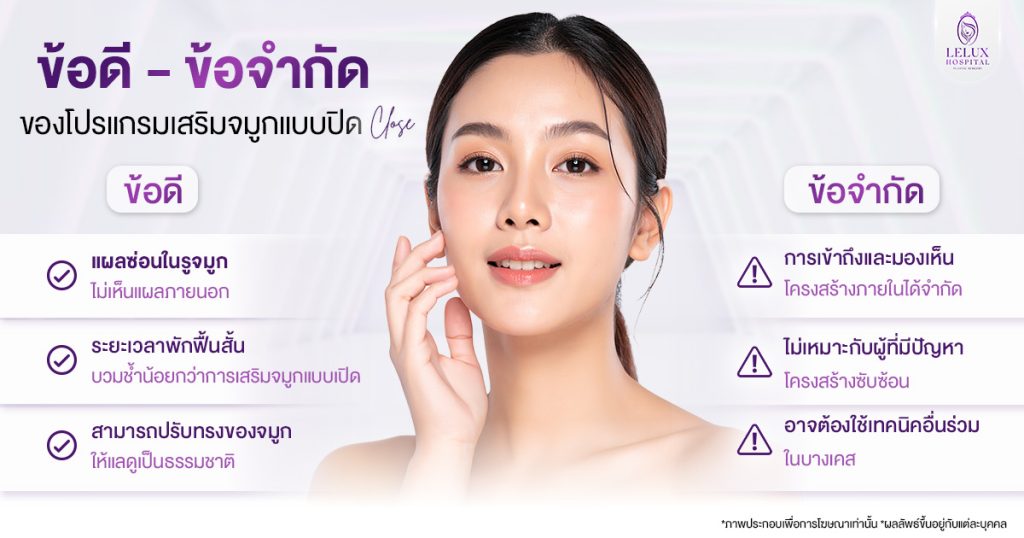 ข้อดีและข้อเสียของเสริมจมูกแบบปิด
