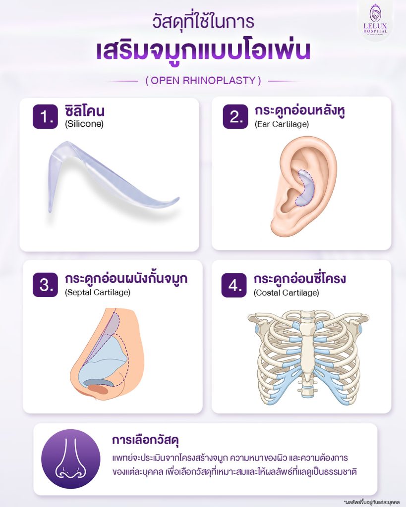 วัสดุที่ใช้ในการเสริมจมูกแบบโอเพ่น