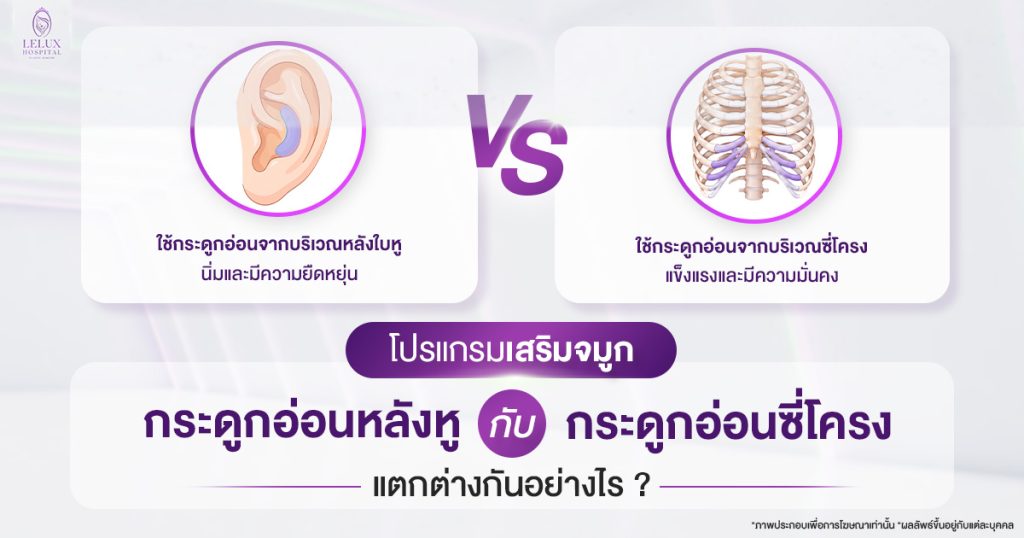เสริมจมูกกระดูกอ่อนหลังหู กับกระดูกอ่อนซี่โครง แตกต่างกันอย่างไร
