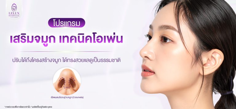 เสริมจมูกแบบโอเพ่น ปรับโครงสร้างได้สวยธรรมชาติ