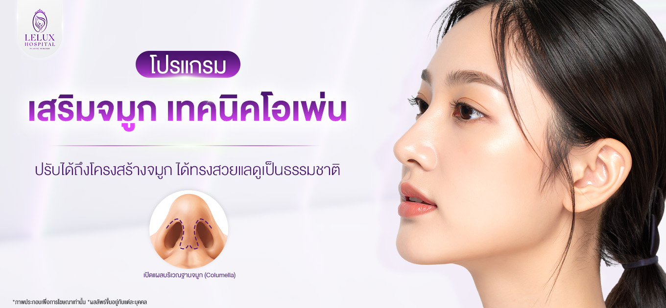 เสริมจมูกแบบโอเพ่น ปรับโครงสร้างได้สวยธรรมชาติ