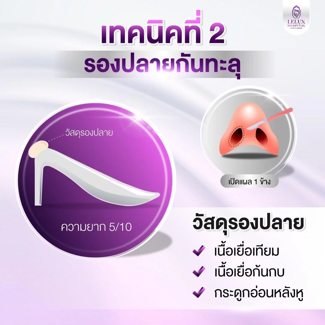 เทคนิคที่ 2 รองปลายกันทะลุ