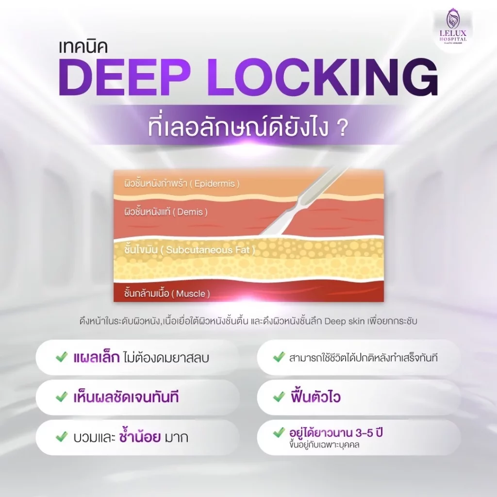 เทคนิค Deep locking