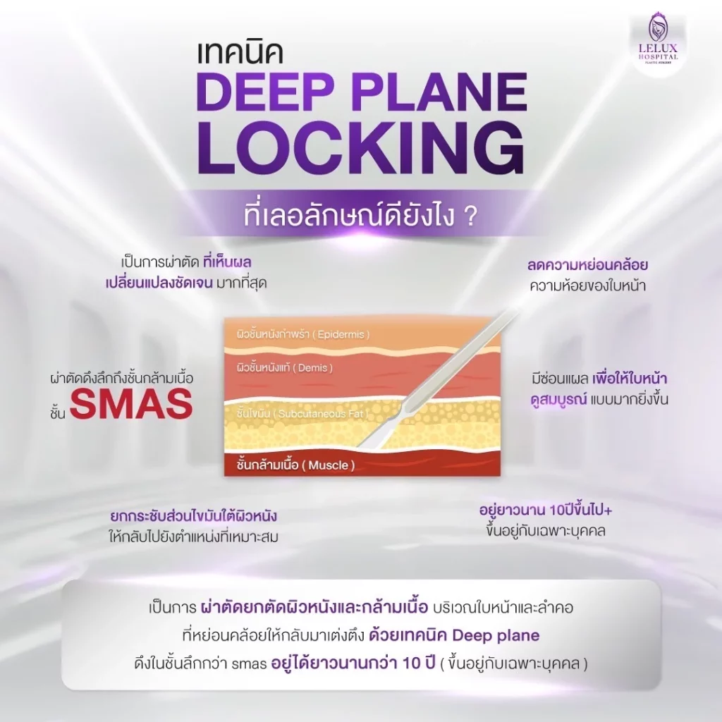 เทคนิค Deep plane locking
