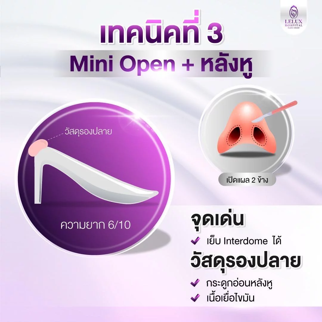 เทคนิคที่ 3 Mini Open