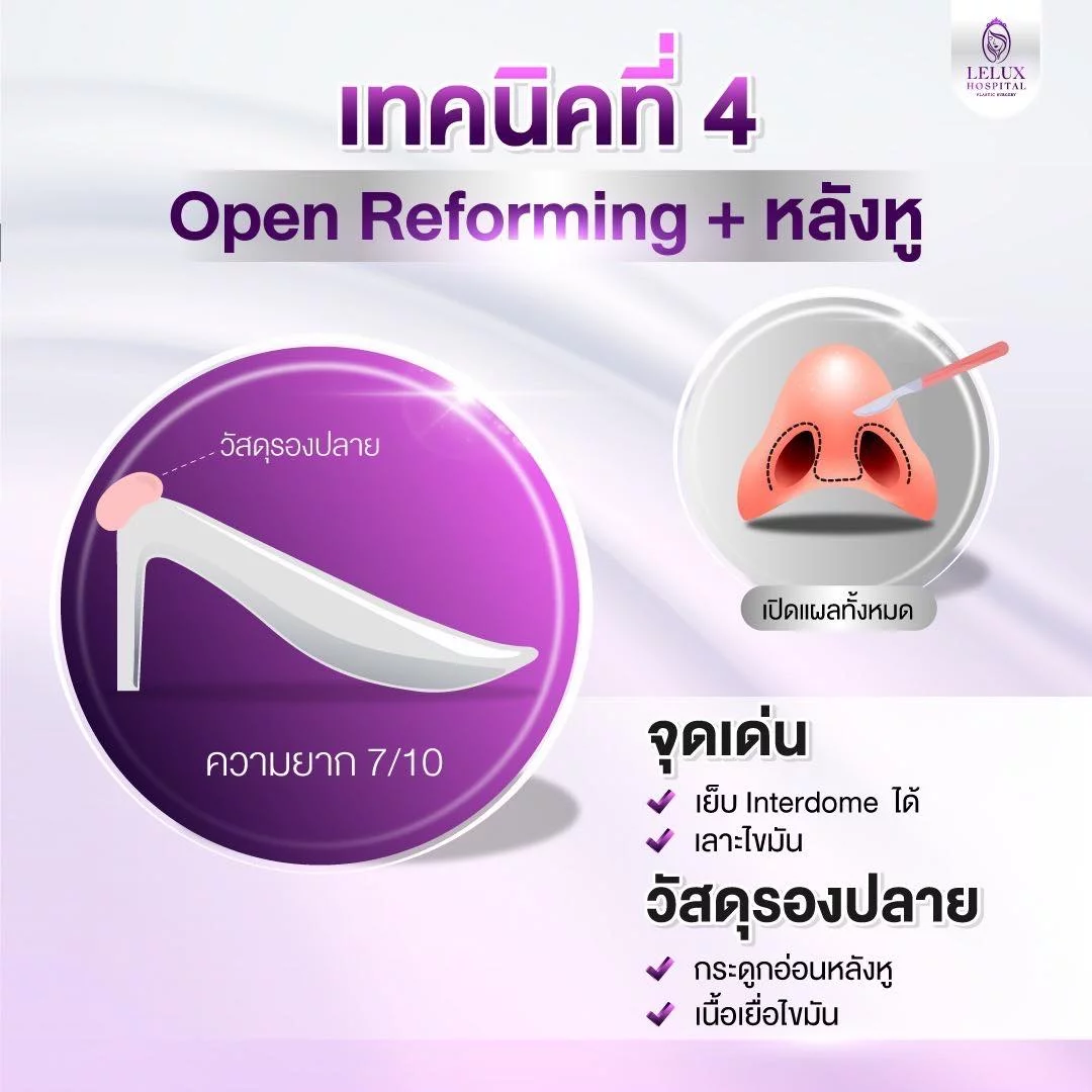 เทคนิคที่ 4 Open Reforming (ปรับฐาน)