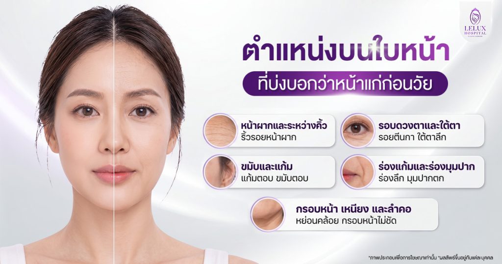 ตำแหน่งบนใบหน้าที่บ่งบอกว่าหน้าแก่ก่อนวัย