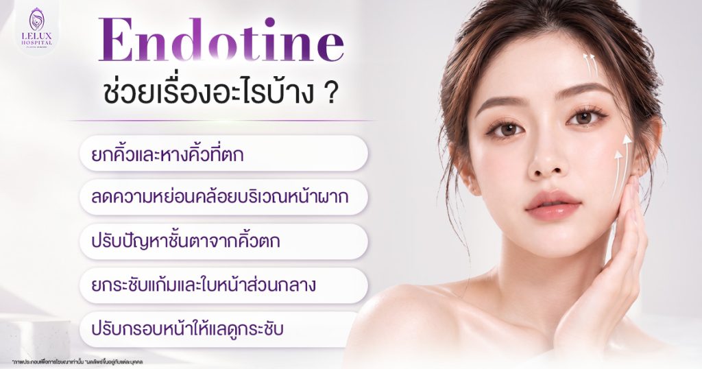 endotine ช่วยเรื่องอะไรบ้าง